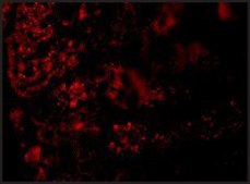 Anti-AGTR1 antibody produced in rabbit affinity isolated antibody, buffered aqueous solution