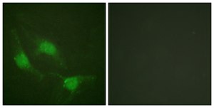 Anti-p53 antibody produced in rabbit affinity isolated antibody