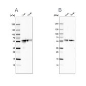 Anti-FGB antibody produced in rabbit Ab1, Prestige Antibodies® Powered by Atlas Antibodies, affinity isolated antibody, buffered aqueous glycerol solution