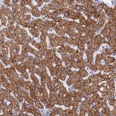 Anti-MMAB antibody produced in rabbit Prestige Antibodies® Powered by Atlas Antibodies, affinity isolated antibody, buffered aqueous glycerol solution