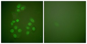 Anti-CREB-BP antibody produced in rabbit affinity isolated antibody