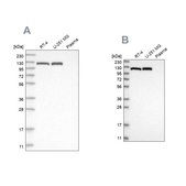 Anti-ACLY antibody produced in rabbit Prestige Antibodies® Powered by Atlas Antibodies, affinity isolated antibody, buffered aqueous glycerol solution