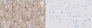 Anti-Neurofilament H Antibody, clone 2N19 ZooMAb® Rabbit Monoclonal recombinant, expressed in HEK 293 cells