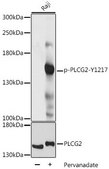Anti-Phospho-PLCG2-Y1217 antibody produced in rabbit