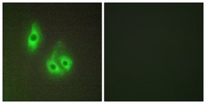 Anti-LAMA3 antibody produced in rabbit affinity isolated antibody
