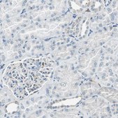 Anti-ME1 antibody produced in rabbit Prestige Antibodies® Powered by Atlas Antibodies, affinity isolated antibody, buffered aqueous glycerol solution
