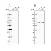 Anti-OPTN antibody produced in rabbit Ab1, Prestige Antibodies® Powered by Atlas Antibodies, affinity isolated antibody, buffered aqueous glycerol solution