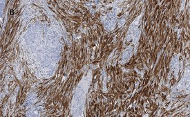 Anti-Calponin 1 Antibody, clone 9D14, ZooMAb® Rabbit Monoclonal recombinant, expressed in HEK 293 cells