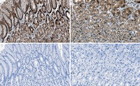 Anti-Cortactin Antibody, clone 1F15 ZooMAb® Rabbit Monoclonal recombinant, expressed in HEK 293 cells
