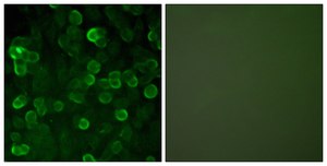 Anti-E-cadherin antibody produced in rabbit affinity isolated antibody
