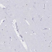 Anti-MYO1F antibody produced in rabbit Prestige Antibodies® Powered by Atlas Antibodies, affinity isolated antibody, buffered aqueous glycerol solution