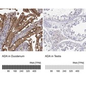 抗-ADA 兔抗 Prestige Antibodies® Powered by Atlas Antibodies, affinity isolated antibody, buffered aqueous glycerol solution