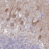 Anti-CACNA2D2 antibody produced in rabbit Prestige Antibodies® Powered by Atlas Antibodies, affinity isolated antibody, buffered aqueous glycerol solution