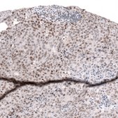 Monoclonal Anti-Smarcb1 Antibody Produced In Mouse Prestige Antibodies® Powered by Atlas Antibodies, clone CL13973, affinity isolated antibody, buffered aqueous glycerol solution