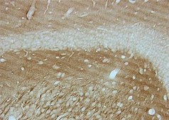 Anti-Tau-1 Antibody, clone PC1C6 clone PC1C6, Chemicon®, from mouse