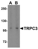 Anti-TRPC3 antibody produced in rabbit affinity isolated antibody