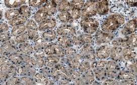 Anti-Cortactin Antibody, clone 1F15 ZooMAb® Rabbit Monoclonal recombinant, expressed in HEK 293 cells