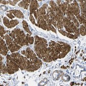 Anti-CNN1 antibody produced in rabbit Prestige Antibodies® Powered by Atlas Antibodies, affinity isolated antibody, buffered aqueous glycerol solution