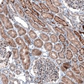 Monoclonal Anti-LAPTM4B antibody produced in mouse Prestige Antibodies® Powered by Atlas Antibodies, clone CL5289, purified immunoglobulin, buffered aqueous glycerol solution