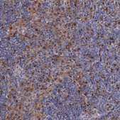 Anti-TYMP antibody produced in rabbit Prestige Antibodies® Powered by Atlas Antibodies, affinity isolated antibody, buffered aqueous glycerol solution