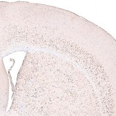 Monoclonal Anti-FOXP2 antibody produced in mouse Prestige Antibodies® Powered by Atlas Antibodies, clone CL5312, purified immunoglobulin, buffered aqueous glycerol solution