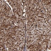 Anti-CD36 antibody produced in rabbit Prestige Antibodies® Powered by Atlas Antibodies, affinity isolated antibody, buffered aqueous glycerol solution