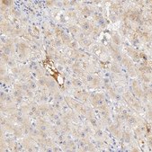 Anti-GC antibody produced in rabbit Prestige Antibodies® Powered by Atlas Antibodies, affinity isolated antibody, buffered aqueous glycerol solution