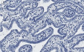 Anti-UBC9/UBE2I Antibody, clone 2H5 ZooMAb® Rabbit Monoclonal recombinant, expressed in HEK 293 cells