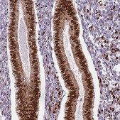 Monoclonal Anti-FUS antibody produced in mouse Prestige Antibodies® Powered by Atlas Antibodies, clone CL0190, purified immunoglobulin, buffered aqueous glycerol solution