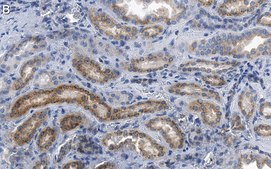 Anti-ACC1 Antibody, clone 1J8 ZooMAb® Rabbit Monoclonal recombinant, expressed in HEK 293 cells