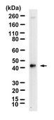 Anti-CD64 Antibody, clone 1B5 ZooMAb® Rabbit Monoclonal recombinant, expressed in HEK 293 cells