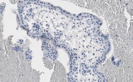 Anti-NF-kB p65 subunit Antibody, clone 1D8 ZooMAb® Rabbit Monoclonal recombinant, expressed in HEK 293 cells