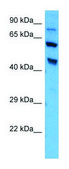 Anti-PDE4D (C-terminal) antibody produced in rabbit affinity isolated antibody