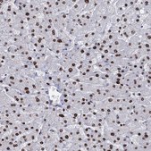Anti-DCPS antibody produced in rabbit Prestige Antibodies® Powered by Atlas Antibodies, affinity isolated antibody, buffered aqueous glycerol solution