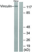 Anti-Vinculin antibody produced in rabbit affinity isolated antibody