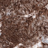 Anti-CD44 antibody produced in mouse Prestige Antibodies® Powered by Atlas Antibodies, clone CL13324, purified by using Protein A, buffered aqueous glycerol solution