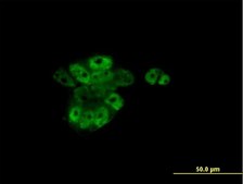 Monoclonal Anti-RARA antibody produced in mouse clone 2C9-1F8, purified immunoglobulin, buffered aqueous solution
