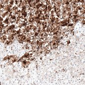 Anti-NTRK1 antibody produced in rabbit Prestige Antibodies® Powered by Atlas Antibodies, affinity isolated antibody, buffered aqueous glycerol solution