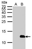 单克隆抗 6X His 标签 小鼠抗 clone GT359, affinity isolated antibody