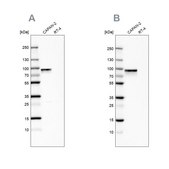 Anti-TGM2 antibody produced in rabbit Prestige Antibodies® Powered by Atlas Antibodies, affinity isolated antibody, buffered aqueous glycerol solution