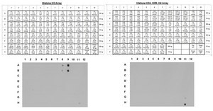 ChIPAb+ Trimethyl-Histone H3 (Lys4) - ChIP Validated Antibody and Primer Set clone CMA304, from mouse, purified by using protein G