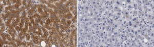 Anti-ABCA1 Antibody, clone 1J11 ZooMAb® Rabbit Monoclonal recombinant, expressed in HEK 293 cells