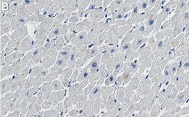 Anti-NDUFB8 Antibody, clone 1E7 ZooMAb® Rabbit Monoclonal recombinant, expressed in HEK 293 cells