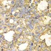 Anti-SOD2 antibody produced in rabbit