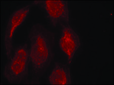 Anti-CDK6 (Ab-13) antibody produced in rabbit affinity isolated antibody