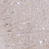 Anti-PDYN antibody produced in rabbit Prestige Antibodies® Powered by Atlas Antibodies, affinity isolated antibody, buffered aqueous glycerol solution