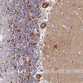 Anti-VDAC2 antibody produced in rabbit Prestige Antibodies® Powered by Atlas Antibodies, affinity isolated antibody, buffered aqueous glycerol solution