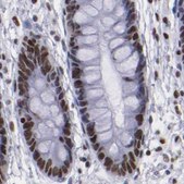 Anti-TERF2 antibody produced in rabbit Ab1, Prestige Antibodies® Powered by Atlas Antibodies, affinity isolated antibody, buffered aqueous glycerol solution