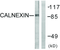 Anti-Calnexin, C-Terminal antibody produced in rabbit affinity isolated antibody