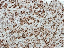 Anti-POU3F2 antibody produced in rabbit